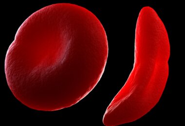 World Sickle Cell Say 2023 v.2
