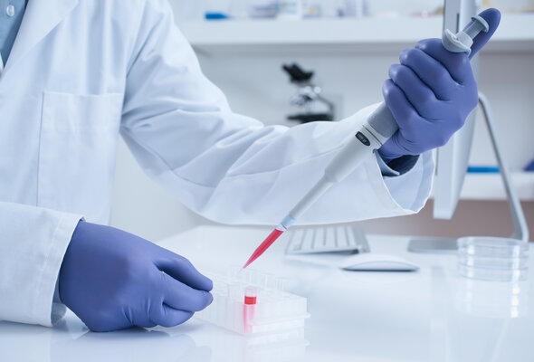 Scientist in lab with blood sample shutterstock 98856650 listing